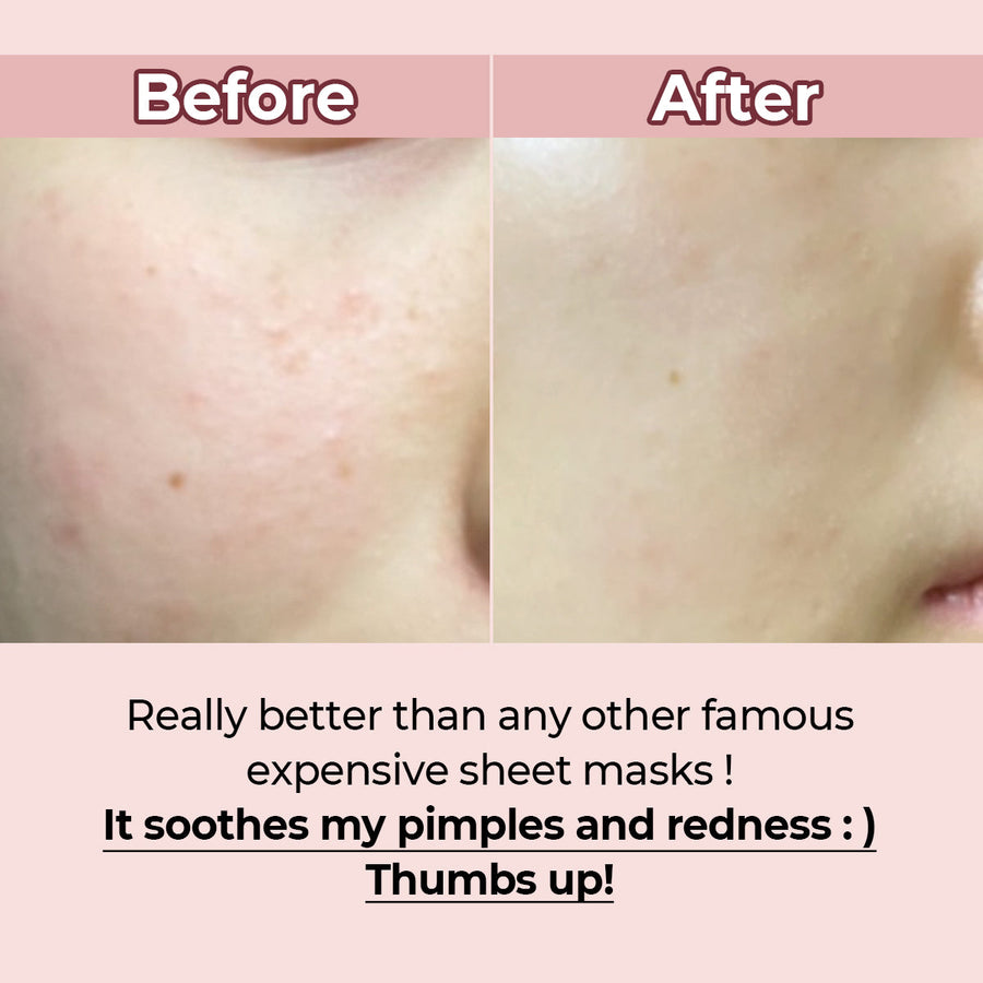 NUMBUZIN No.3 Tingle-Pore Soothing Sheet Mask (27ml) - CHERIPAI