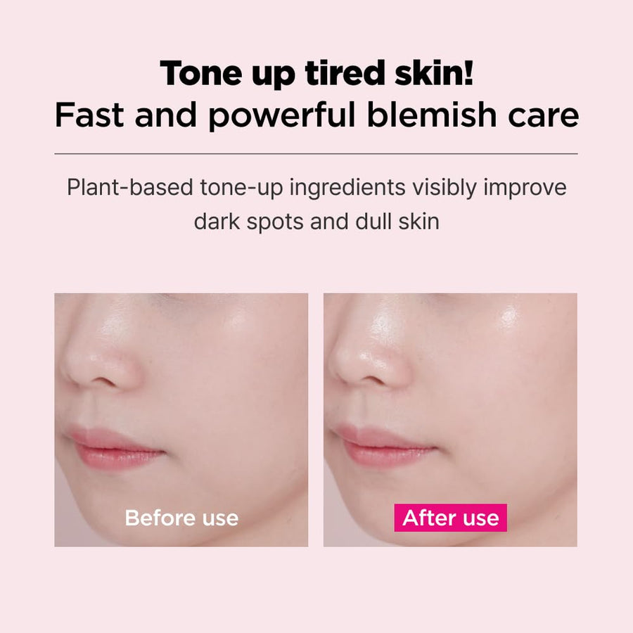 ISOI Blemish Care Mask (20ml)